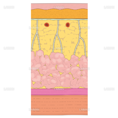 乳腺組織 Sサイズ Laiman Stockweb メディカルイラスト素材のダウンロード販売