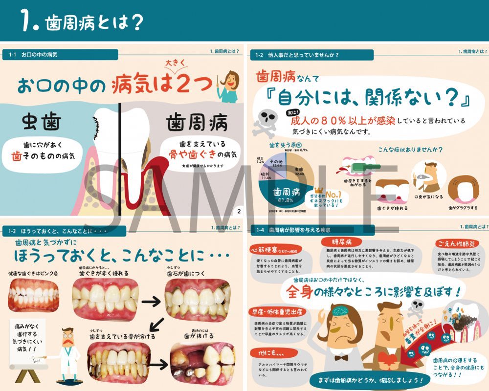 歯周病説明ツール & 学習キット 個人セット | 歯科衛生士のための 