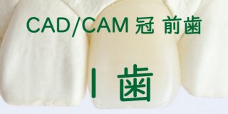 CAD/CAM冠 大臼歯１歯