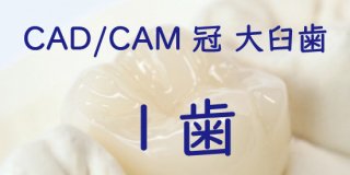 CAD/CAM冠 大臼歯１歯