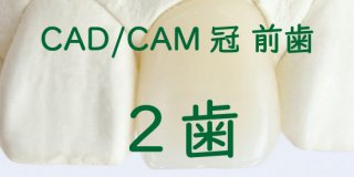 CAD/CAM冠 大臼歯２歯