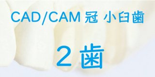 CAD/CAM冠 小臼歯 完成まで ２歯