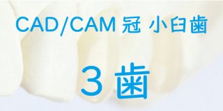 CAD/CAM冠 小臼歯 完成まで ３歯