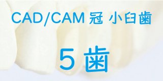 CAD/CAM冠 小臼歯 完成まで ５歯