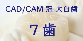 CAD/CAM冠 大臼歯 完成まで ７歯