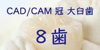 CAD/CAM冠 大臼歯８歯