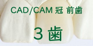 CAD/CAM冠 大臼歯３歯