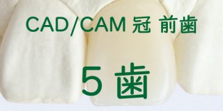 CAD/CAM冠 大臼歯５歯