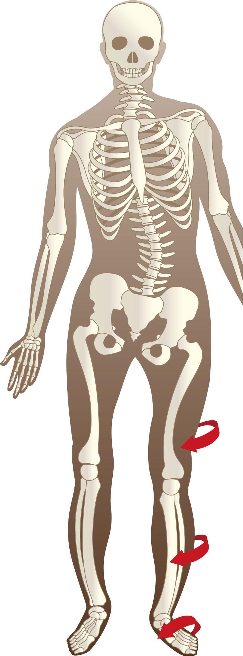 歪んだ骨格のイラスト